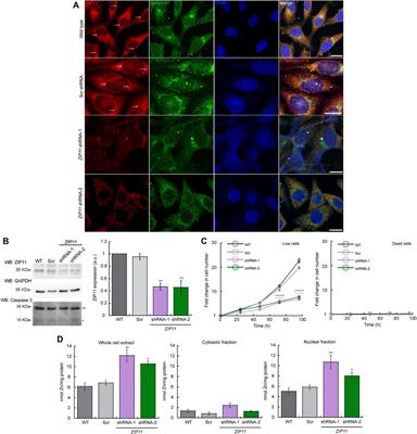 ZIP11 Regulates Nuclear Zinc Homeostasis in HeLa Cells and Is Required for Proliferation and Establishment of the Carcinogenic Phenotype